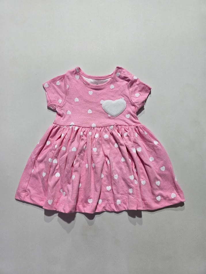 Baby's frock