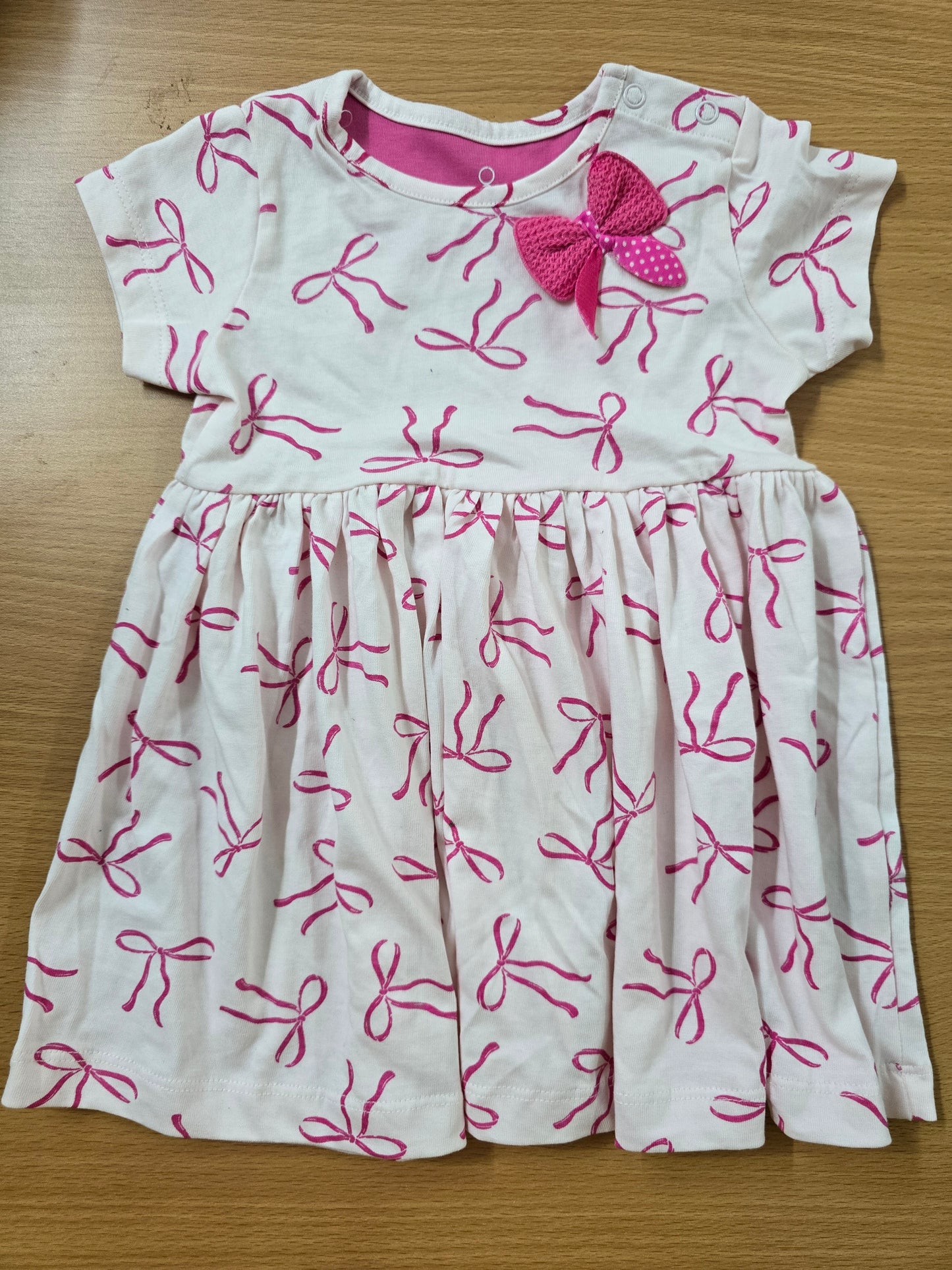 Baby's frock - bow