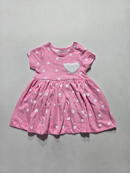 Baby's frock