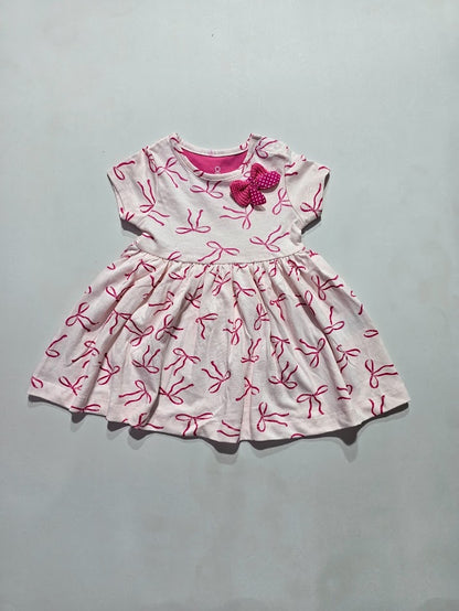 Baby's frock